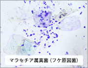 脱スピノワ コラージュフルフルの実力とは ル スピノワで脂漏性皮膚炎から解放